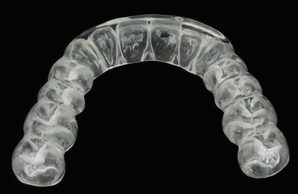 Mail-Order Braces - No Match for Personal Orthodontic Trea